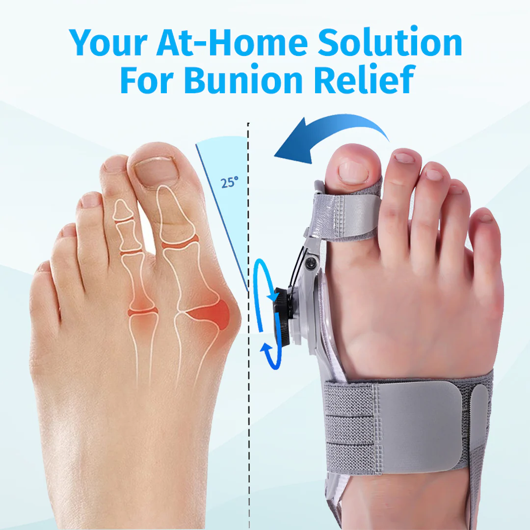 Bunion Fix - Natural At-Home Bunion